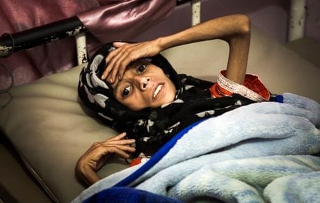 بیش از ۲ هزار زن در یمن قربانی تجاوزات ائتلاف سعودی شده‌اند