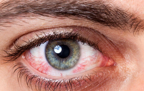  توصیه هایی برای سلامت چشم ها