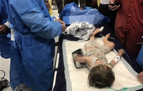 نجات دست کودک ۲ساله از لای چرخ گوشت