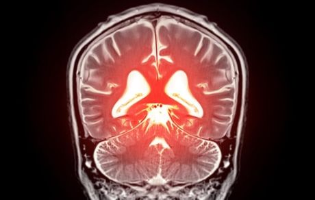با کشفی جدید، درمان زوال عقل ممکن می‌شود