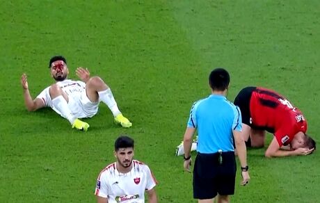 عالیشاه دچار عارضه مغزی نشده است