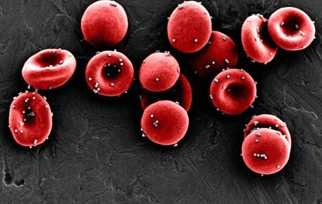 نانوذرات دارویی به کمک درمان سرطان می‌آیند