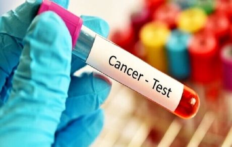 شناسایی ۲۰۰ نوع جدید سرطان تا چهار سال آینده