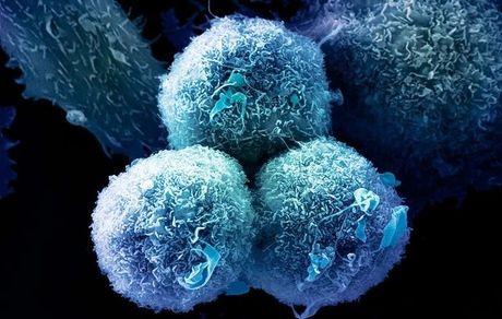 کشف داروی جدیدی که تومورهای سرطانی را از بین می‌برد