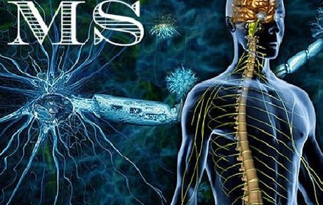 بیماران ‌ام‌اس، سرگردان در بازار سیاه دارو