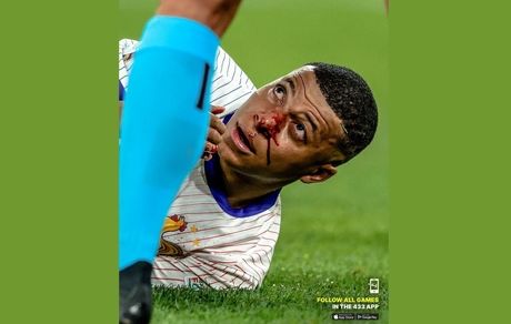 بینی ام‌باپه در اولین بازی فرانسه در یورو ۲۰۲۴ شکست!