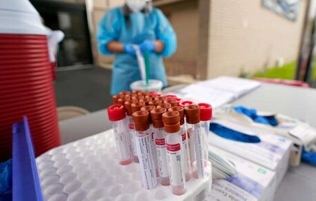 دوام آنتی‌بادی‌های ویروس کرونا حداقل ۳ ماه است