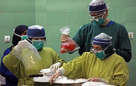 افزایش ۶۶ درصدی اهدای عضو در کشور نسبت به سال گذشته