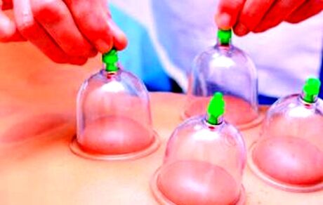 بادکش درمانی در طب ایرانی