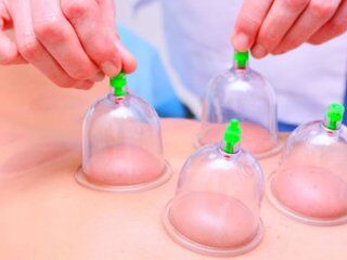 بادکش درمانی در طب ایرانی