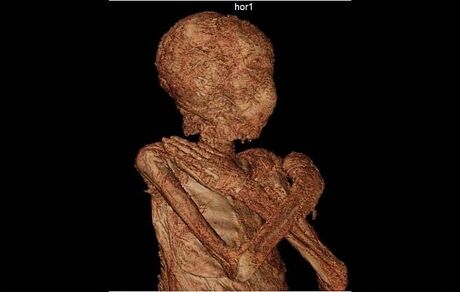 دلیل حفظ جنین در بدن زن مومیایی ۲ هزار ساله مشخص شد