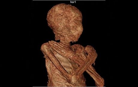 دلیل حفظ جنین در بدن زن مومیایی ۲ هزار ساله مشخص شد