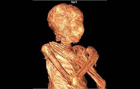 دلیل حفظ جنین در بدن زن مومیایی ۲ هزار ساله مشخص شد