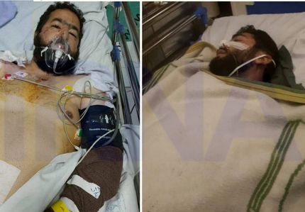 آخرین وضعیت دو طلبه مجروح در حادثه حرم رضوی
