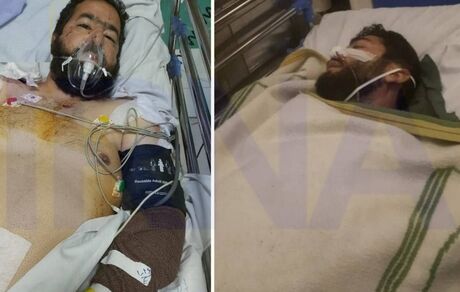 آخرین وضعیت دو طلبه مجروح در حادثه حرم رضوی