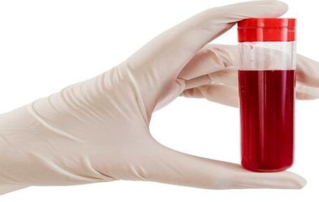 علایمی که می‌گویند گردش خون شما مشکل دارد