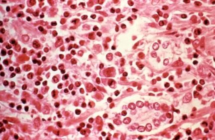 جان باختن ۳ نفر بدلیل شیوع یک بیماری حاد تنفسی در یک کشتی مسافرتی در اقیانوس اطلس