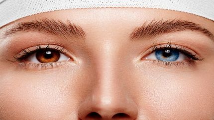 جراحی تغییر رنگ چشم، خطرناکترین عمل زیبایی است