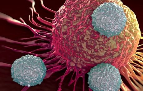 ۴۰ درصد سرطان‌‌ها قابل پیشگیری هستند!