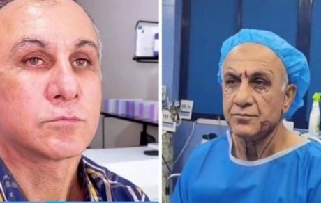 مردی که با جراحی جوان شد!