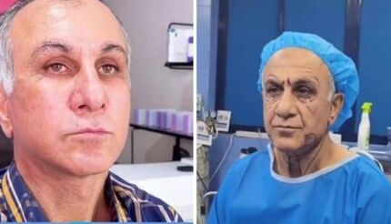 مردی که با جراحی جوان شد!