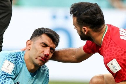 یک موسسه پزشکی انگلیس: ماندن بیرانوند در زمین اشتباه محض بود / احتمال آسیب مغزی برای دروازه‌بان ایران وجود داشت