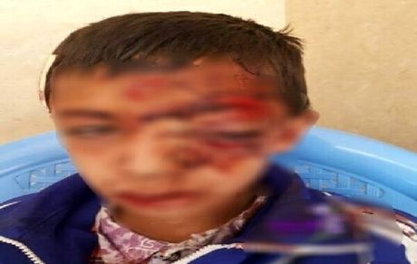 تناقض‌گویی در موضوع سقوط دانش آموز قاینی از کوه