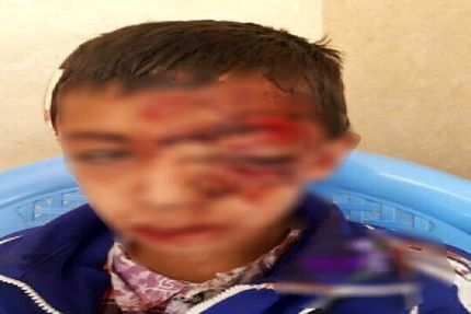 تناقض‌گویی در موضوع سقوط دانش آموز قاینی از کوه