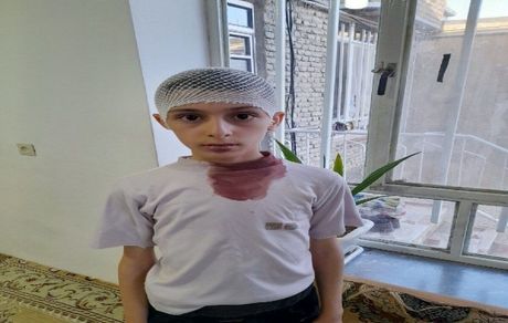 اتفاقی عجیب در یک مدرسه: معلم، سر دانش آموز را با تخت پاک‌کن شکست