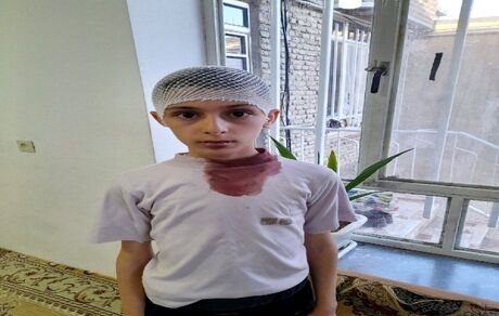 اتفاقی عجیب در یک مدرسه: معلم، سر دانش آموز را با تخت پاک‌کن شکست