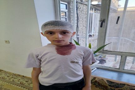 اتفاقی عجیب در یک مدرسه: معلم، سر دانش آموز را با تخت پاک‌کن شکست