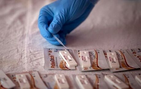 تست کرونا تحت پوشش بیمه ها قرار گرفت/سوش جدید لامبدا قدرت سرایت بیشتری دارد