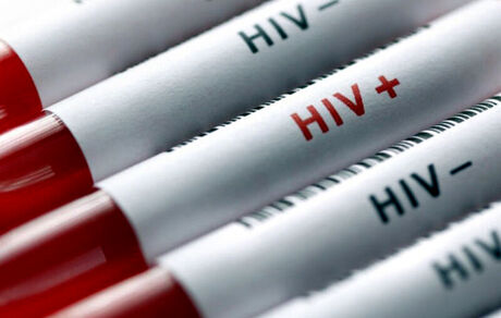شناسایی ۷۸۶ بیمار مبتلا به HIV در استان خراسان رضوی