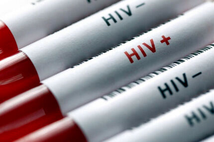شناسایی ۷۸۶ بیمار مبتلا به HIV در استان خراسان رضوی
