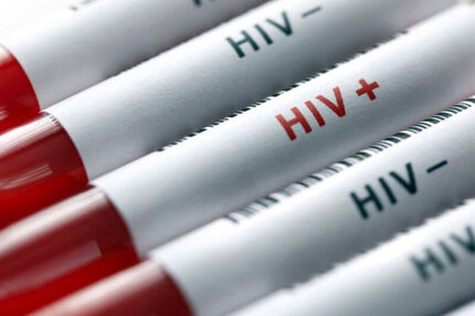 شناسایی ۷۸۶ بیمار مبتلا به HIV در استان خراسان رضوی