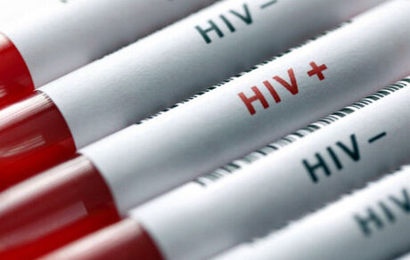 شناسایی ۷۸۶ بیمار مبتلا به HIV در استان خراسان رضوی