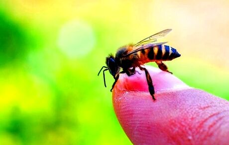  بعد از نیش زنبور عسل چه کار کنیم