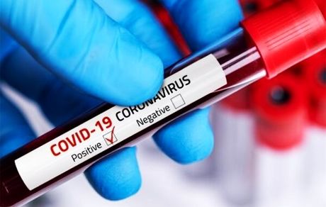 راستی آزمایی سازمان لیگ از استقلالی‌ها/ تست‌ها باید تکرار شود!