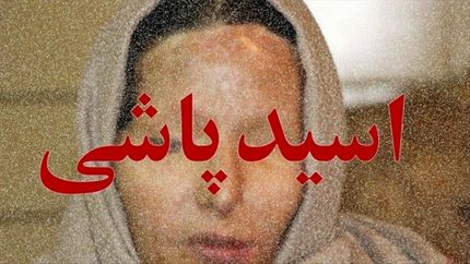 اسیدپاشی این بار در شیراز، ماجرا چه بود؟