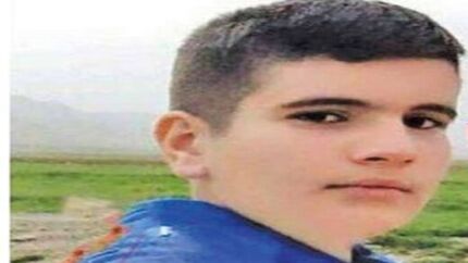 پسر نوجوان دوسال بعد از اسیدپاشی تسلیم مرگ شد