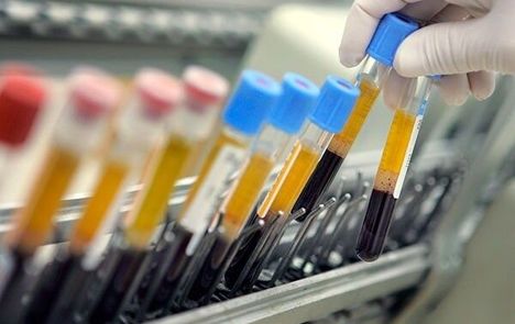 محرومیت ۲ ورزشکار رشته دوومیدانی بدلیل دوپینگ