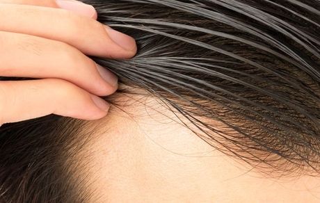 موی چرب و 17 روش برای خلاص شدن از آن