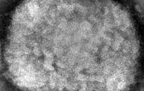 آبله میمونی در فرانسه شایع تر شد