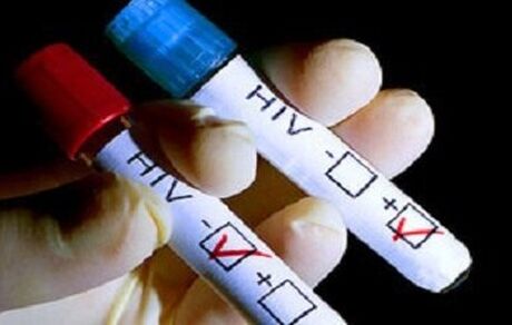 شناسایی ۲۲ بیمار مبتلا به HIV در نیشابور