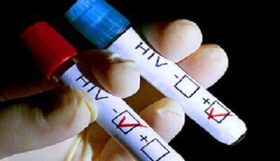 شناسایی ۲۲ بیمار مبتلا به HIV در نیشابور