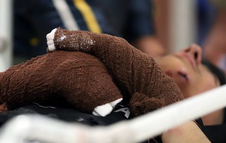  مصدومیت ۲ نوجوان ۱۵ ساله در پی انفجار بمب دست ساز در زاهدان