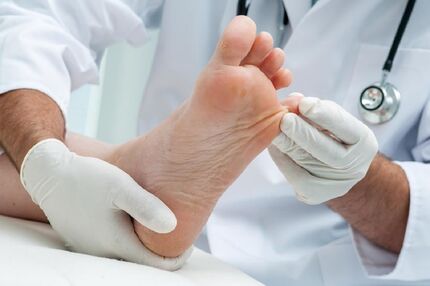 ۱۲ دستورالعمل طبیعی برای درمان میخچه پا