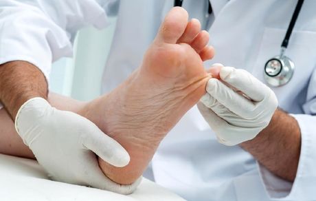 ۱۲ دستورالعمل طبیعی برای درمان میخچه پا