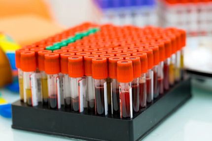 پیشبینی زودهنگام ابتلا به دیابت با یک آزمایش خون ساده