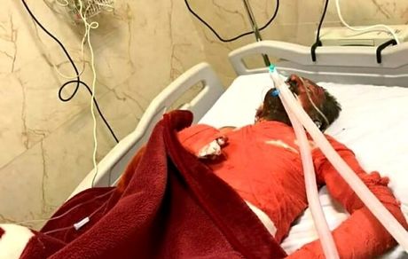 فرزند شهید یاسوجی که خودسوزی کرده بود درگذشت